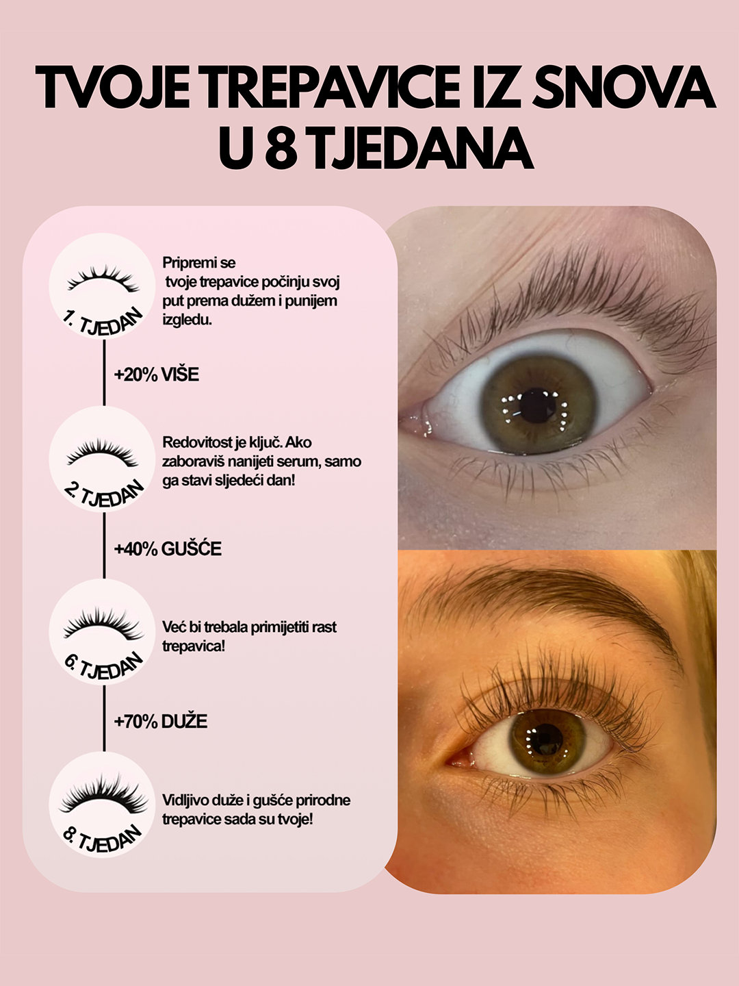 Serum za rast trepavica