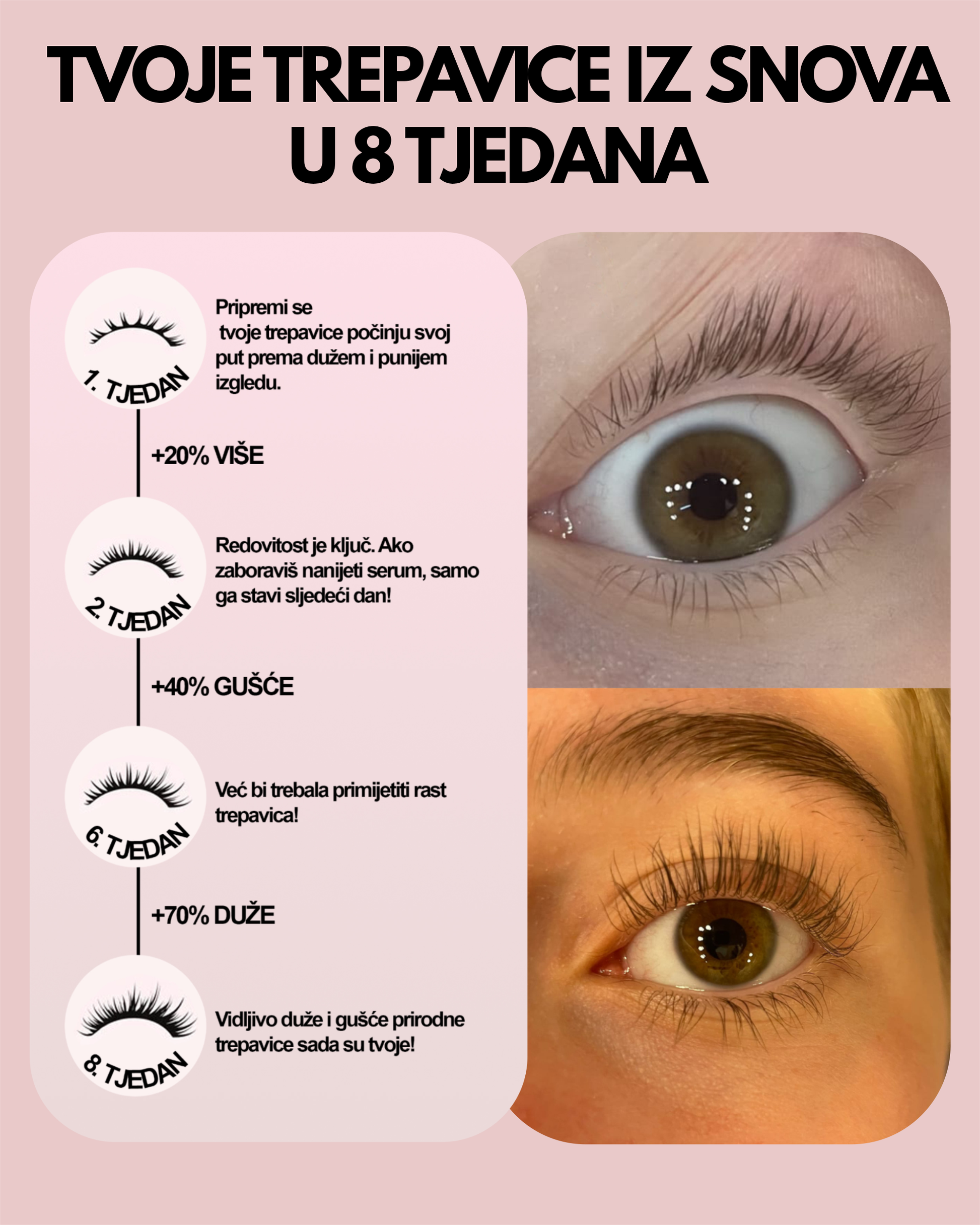 Serum za rast trepavica